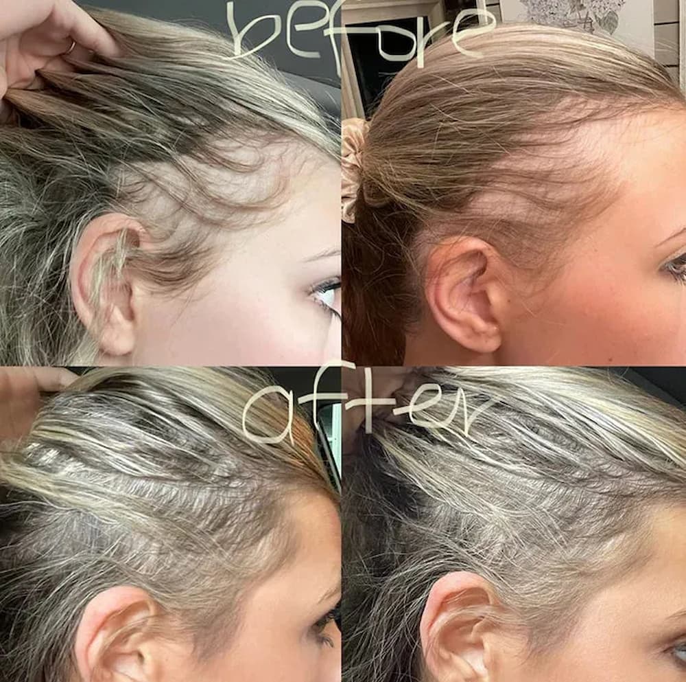Vanura – Red Light Brush with Deep Scalp Stimulation